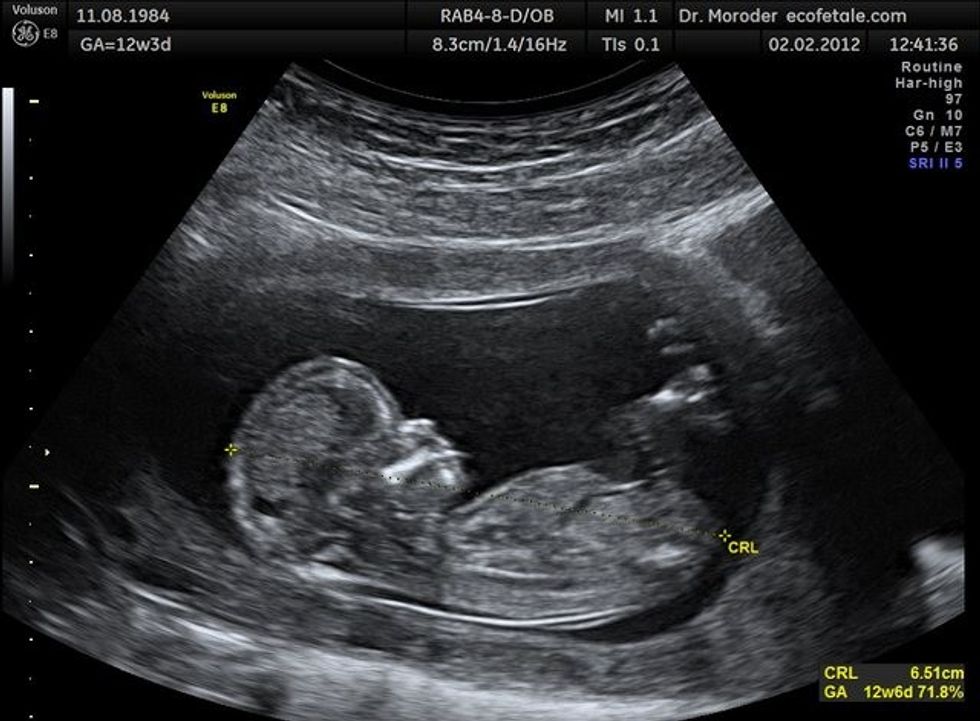 e38024bcc47e69a9c8678420ca8ffea8