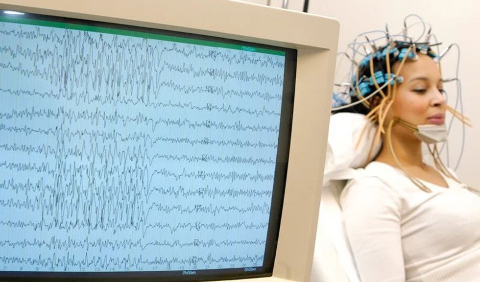electroencephalogram eeg on a 27 year old woman