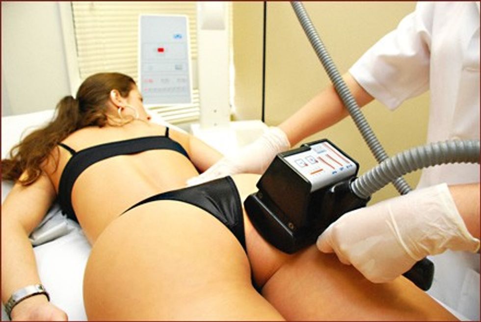 Endermologia imagem 5