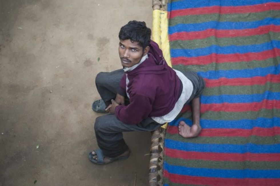 *** EXCLUSIVE - VIDEO AVAILABLE *** FARRUKHABAD, INDIA - DECEMBER 09: Arun Kumar Rajput poses for a photograph at his house on December 09, 2015 in Farrukhabad, India. A YOUNG man with FOUR legs appealed to doctors to amputate his two extra limbs. Arun Kumar, 22, was born with two extra legs growing from his lower back - one underdeveloped and the other permanently bent at the knee. After living for 15 years without any kind of treatment, Arun, from Uttar Pradesh, India, appealed through social media for medical help to remove his extra legs. A team of specialists at Fortis Hospital in Delhi responded to Arunís plea for help and organised a series of tests to find out how the legs are attached and if he can be treated. **CONDITION OF USAGE: The following plug must be used in print and/or online: Arun's story appears in Body Bizarre, Thursday November 3, 10pm, on TLCî credit: TLC/ Barcroft Productions** PHOTOGRAPH BY Arkaprava Ghosh / Barcroft Images London-T:+44 207 033 1031 E:hello@barcroftmedia.com New York-T:+1 212 796 2458 E:hello@barcroftusa.com New Delhi-T:+91 11 4053 2429 E:hello@barcroftindia.com www.barcroftimages.com