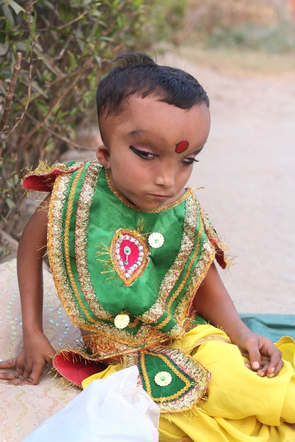 *** EXCLUSIVE - VIDEO AVAILABLE *** JALANDHAR, INDIA - OCTOBER 27: Pranshu poses for the camera while being photographed on October 27, 2016 in Jalandhar, India. A SIX-YEAR-OLD Indian boy is worshiped by locals who believe he is the reincarnation of the Hindu god Ganesha. Pranshu, from Jalandhar in the Indian state of Punjab, was born with a mystery medical condition that has left him with a swollen forehead and deep set, narrow eyes. Although he is unable to walk, villagers believe Pranshu is a divine child and have nicknamed him 'Lord Ganeshaí - flocking to see him outside the nearby mosque. PHOTOGRAPH BY Ajay Verma / Barcroft Images London-T:+44 207 033 1031 E:hello@barcroftmedia.com - New York-T:+1 212 796 2458 E:hello@barcroftusa.com - New Delhi-T:+91 11 4053 2429 E:hello@barcroftindia.com www.barcroftimages.com