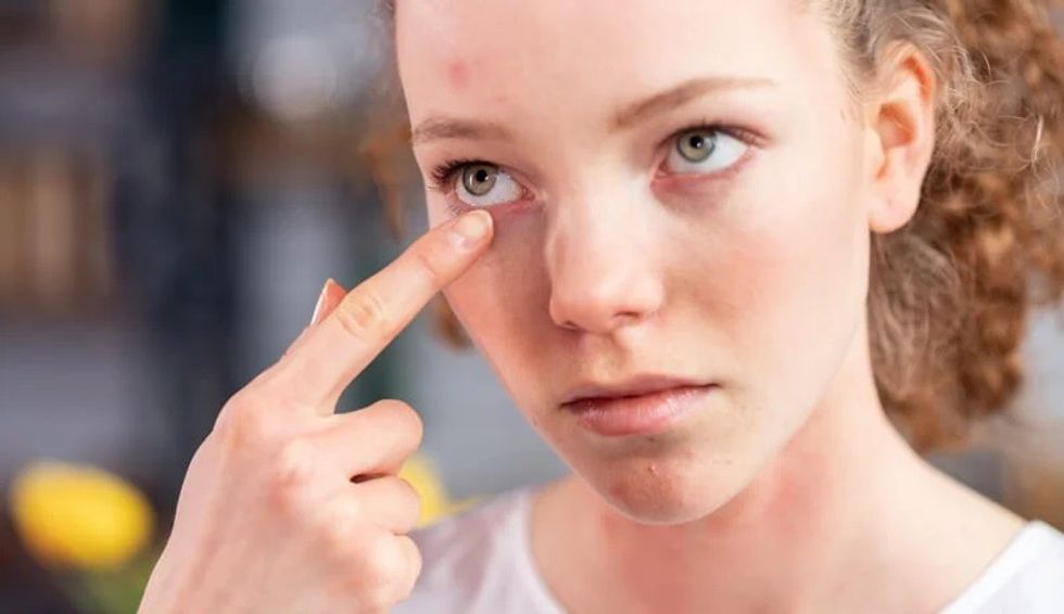 eyeshadow makes eyes itch