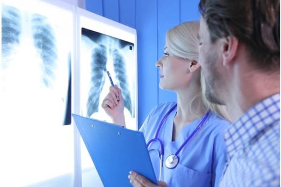 fases del cancer de pulmon