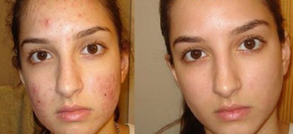 fc3561ca4ff2d1451b850055ac0284a4