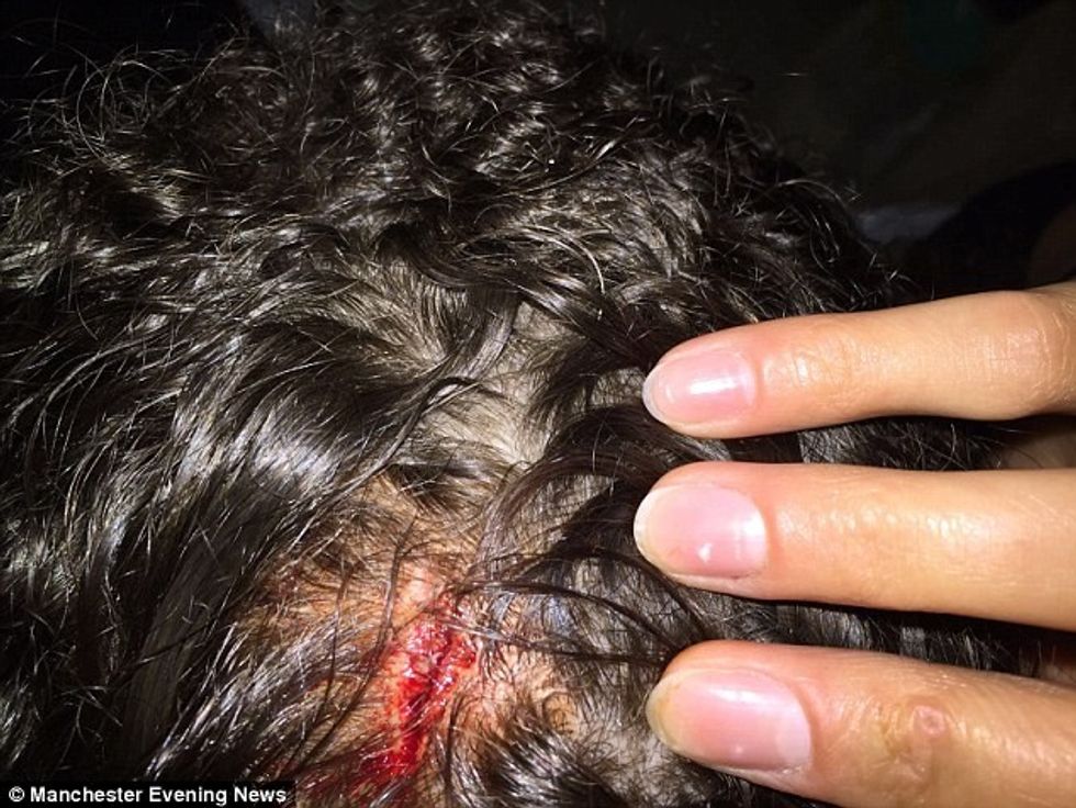 Fëmijët e lagjes e qëlluan me tullë në kokë sepse u kerkoi qe te mbajne qetesi foto 2