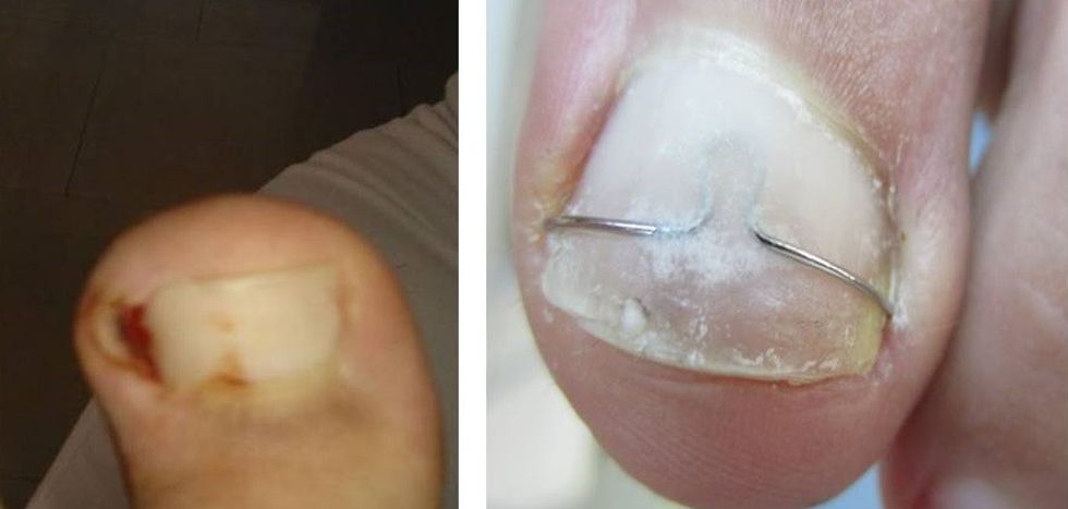 fghfhfghfghfghterterty