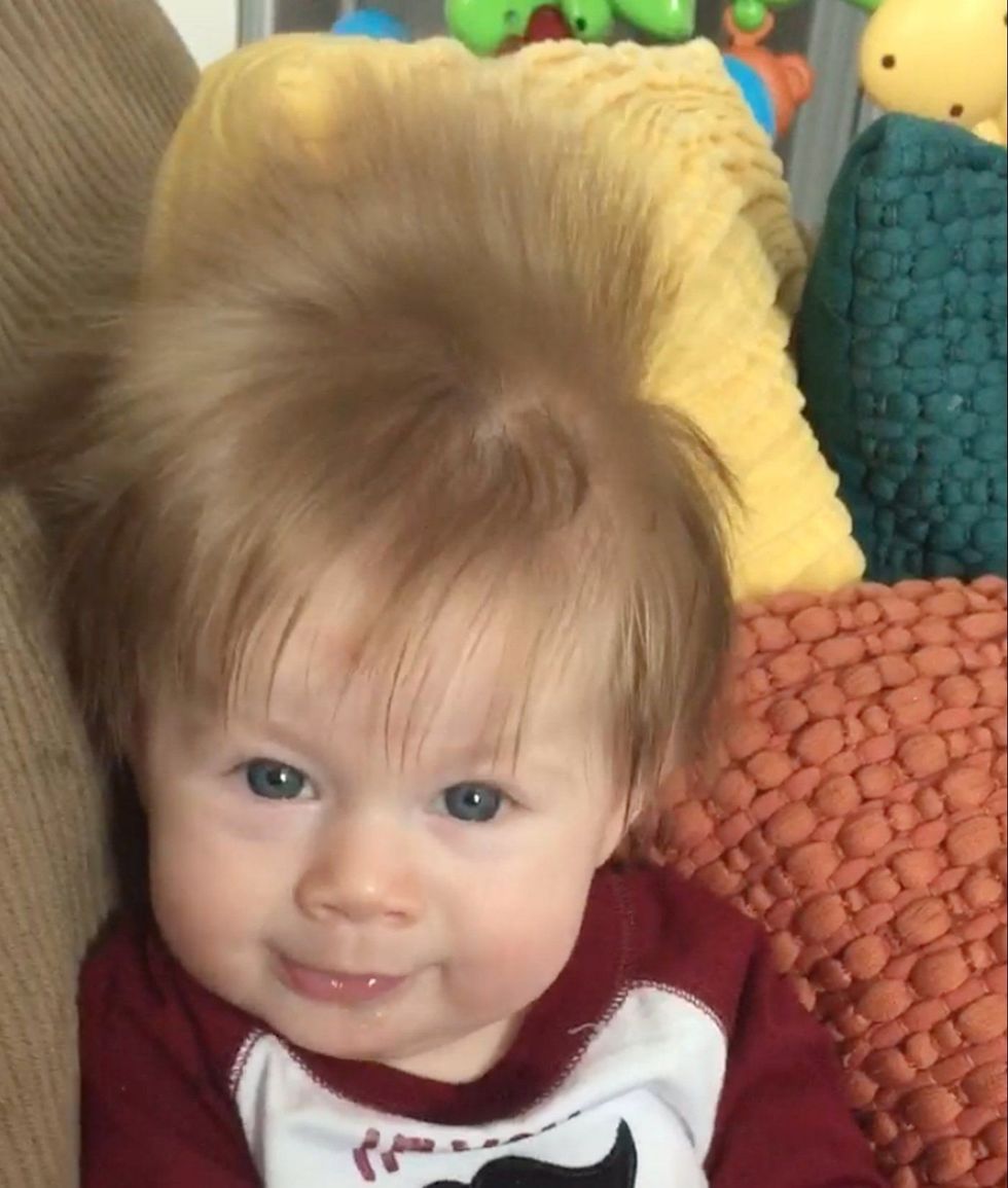 Flokët e gjatë të bebes u panë edhe në fotografinë me ultrazë foto 3