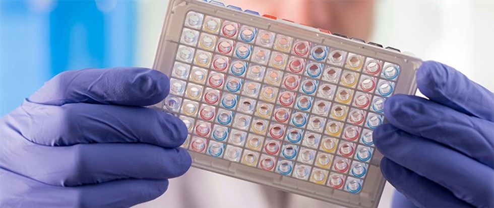 food intolerance lab testing e1527687932421