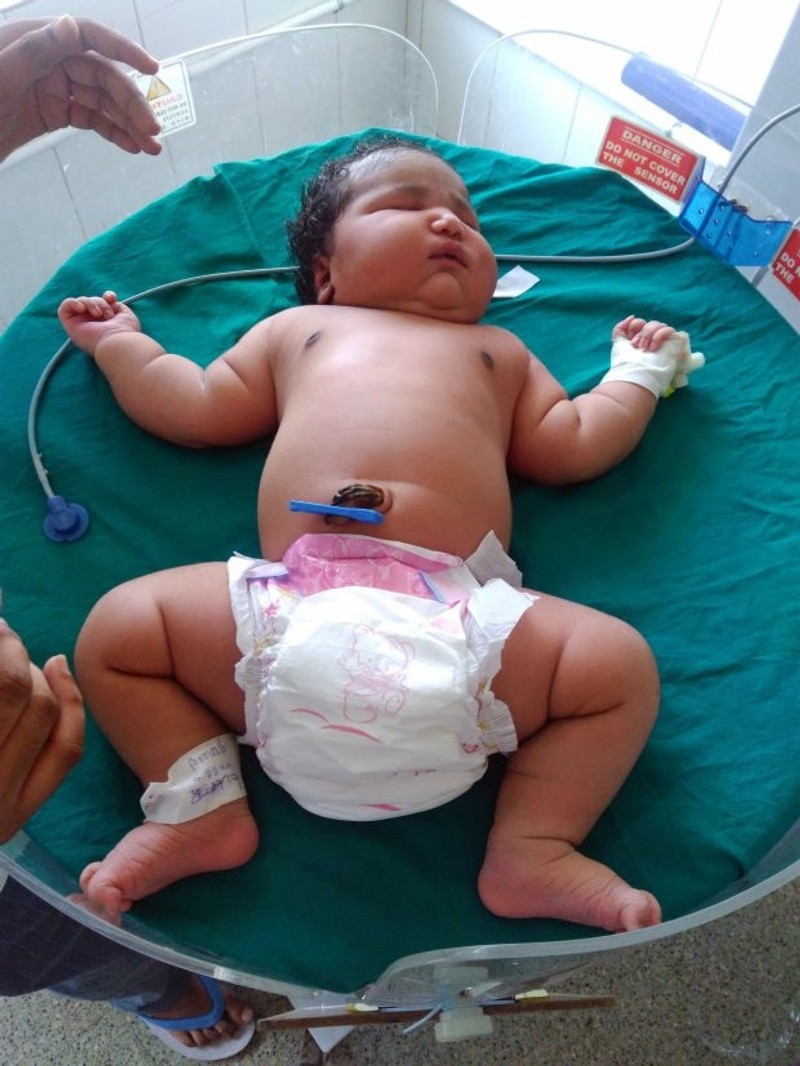 The heaviest baby in the world is born (Photo/Video) - Telegraph, image size:800x1066