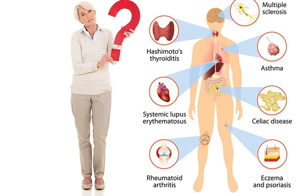 Genetic Testing DNA Testing Autoimmune
