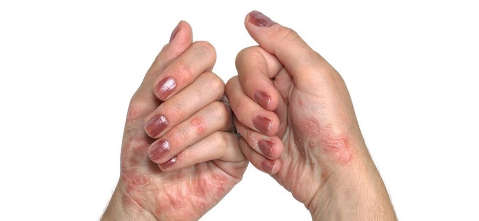 GettyImages 155418338 56e35add3df78c5ba056e820