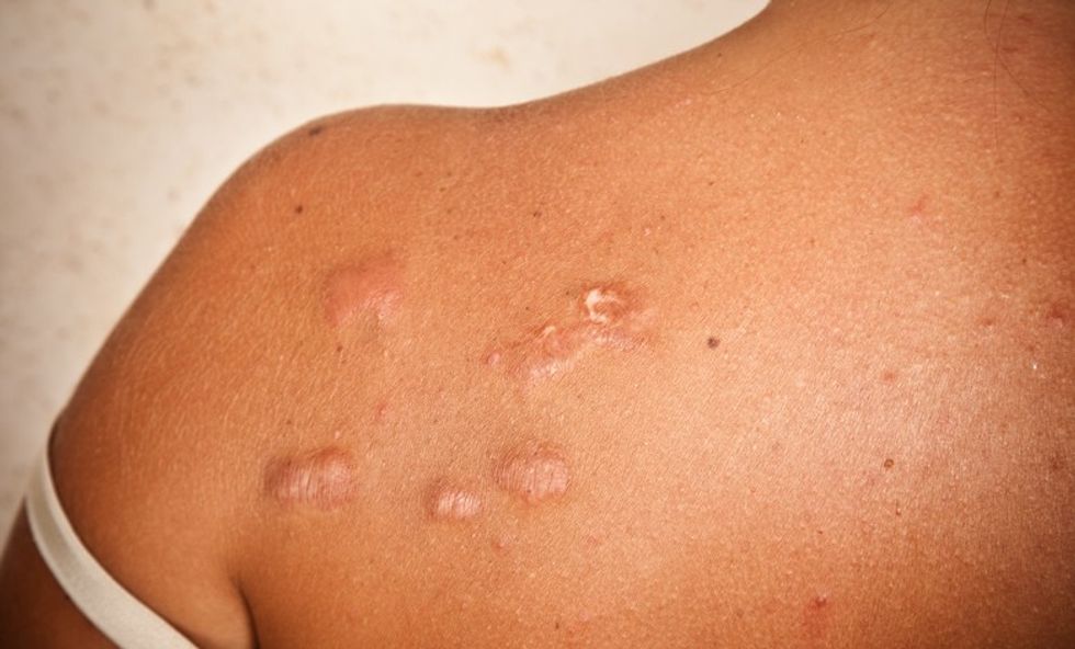 GettyImages 176065436