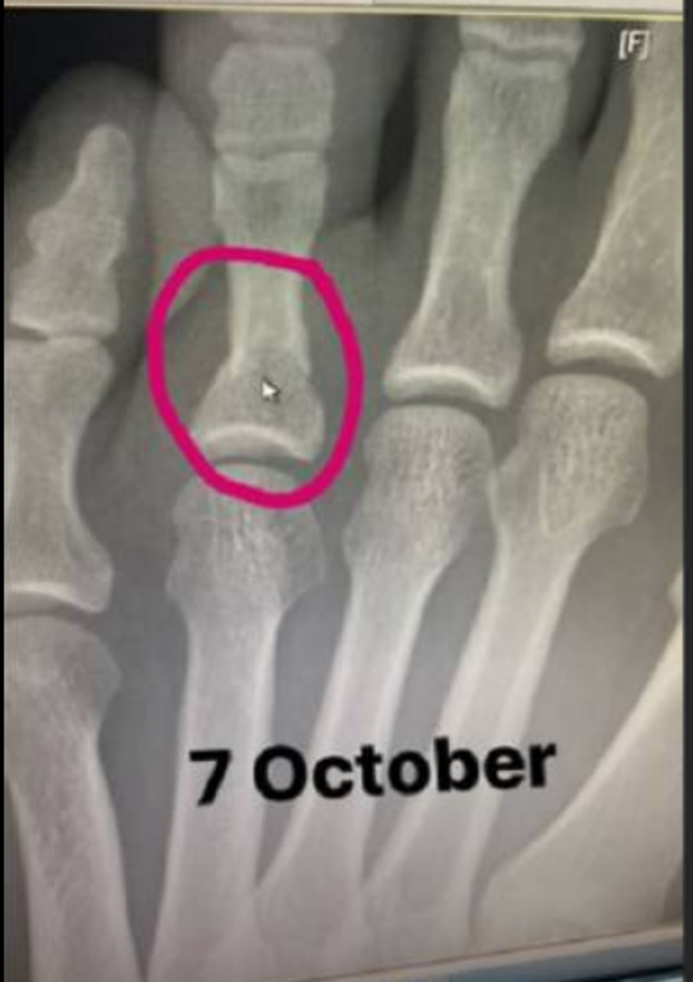 gishtat e thyer e1603822703491