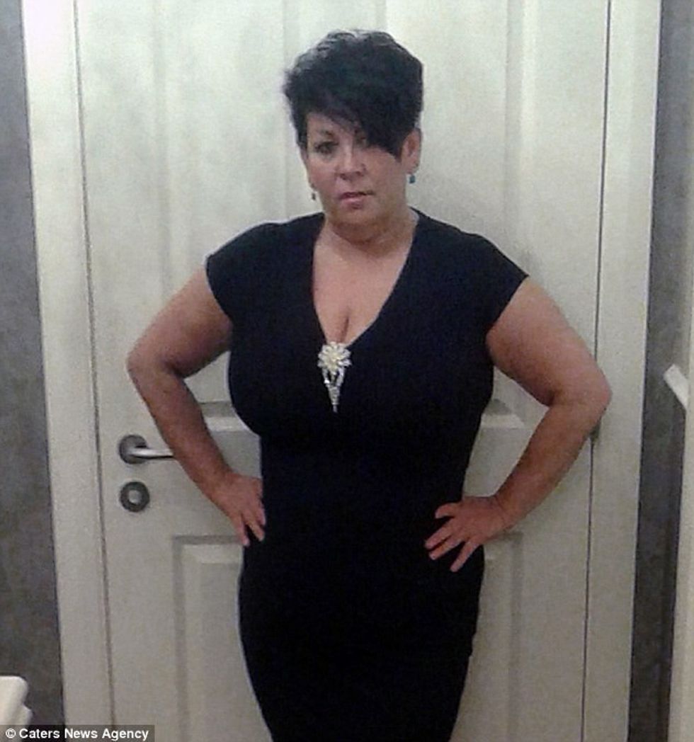 Gruas që dukej shtatzënë për tri vite i hoqen tumorin ne madhesi te shalqirit foto 2