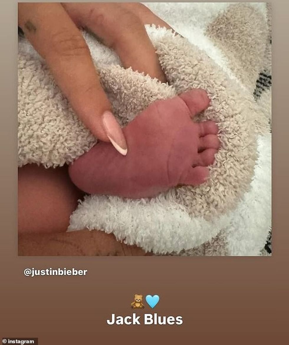 Hailey e ripostoi foton në Instagram Stories menjëherë pas postimit fillestar të Justin. Ajo e shkruajti atë me një emoji me arush pelushi dhe një zemër blu, duke shkruar,