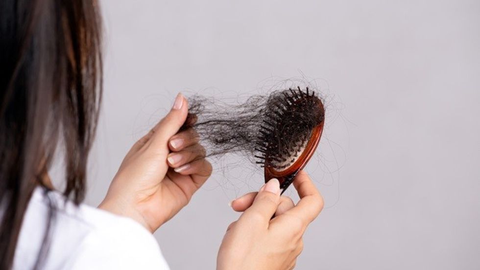 hair loss universal 1