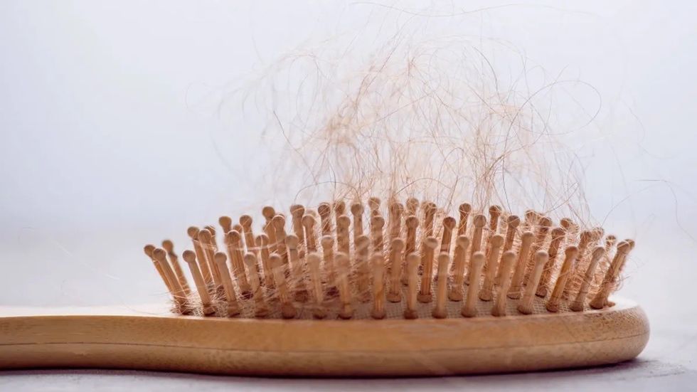 hair loss