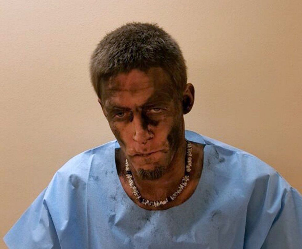 Hajni u turpëruar keq pasi ngeci në oxhakun e një shtëpie foto 2