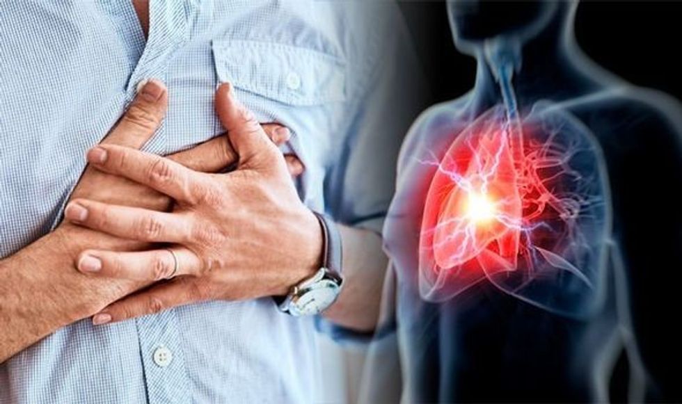 Heart attack Seven foods to cut down on to slash risk of life threatening condition 1060281