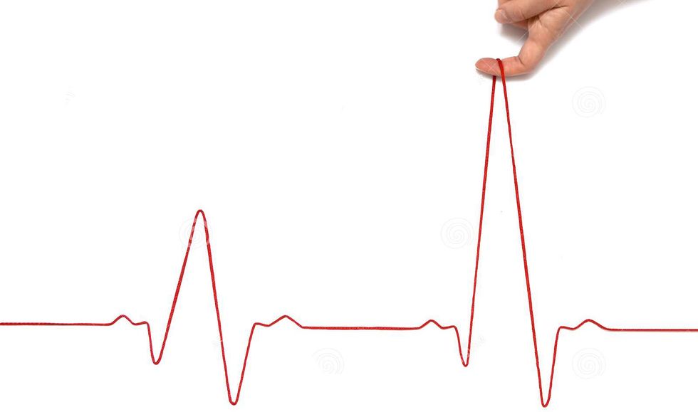 heartbeat rhythm graph white background electric cardiogram blood pressur