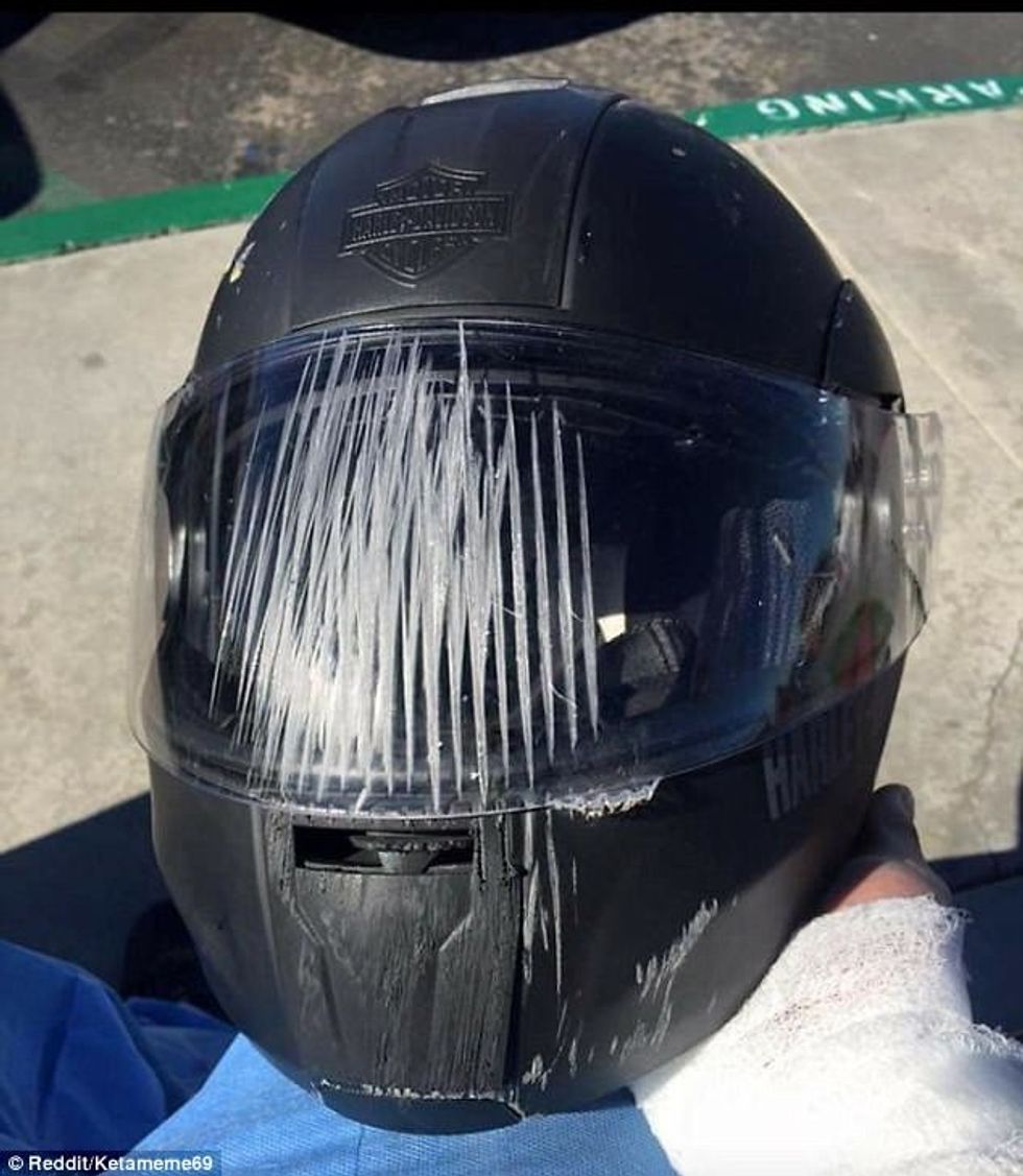 Helmetat shpëtojnë jetë dhe këto raste e tregojnë më së miri foto 3
