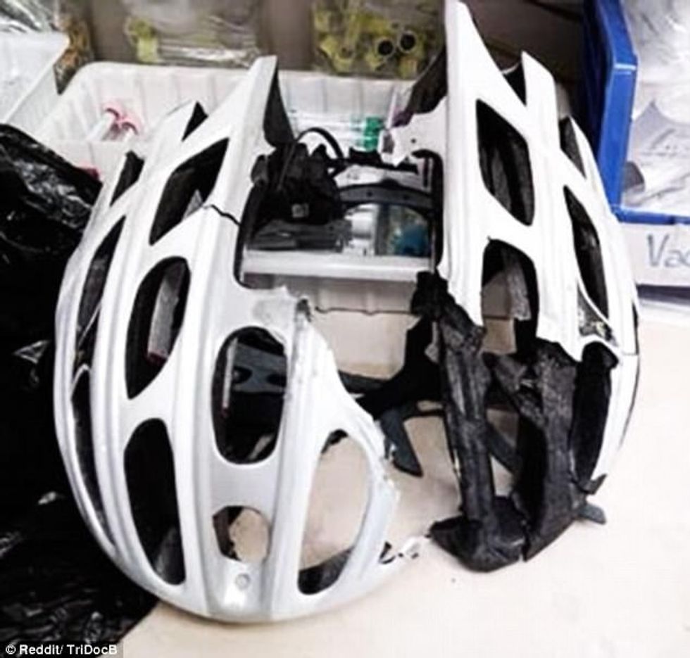 Helmetat shpëtojnë jetë dhe këto raste e tregojnë më së miri foto 4