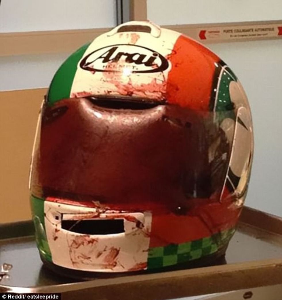 Helmetat shpëtojnë jetë dhe këto raste e tregojnë më së miri foto 6