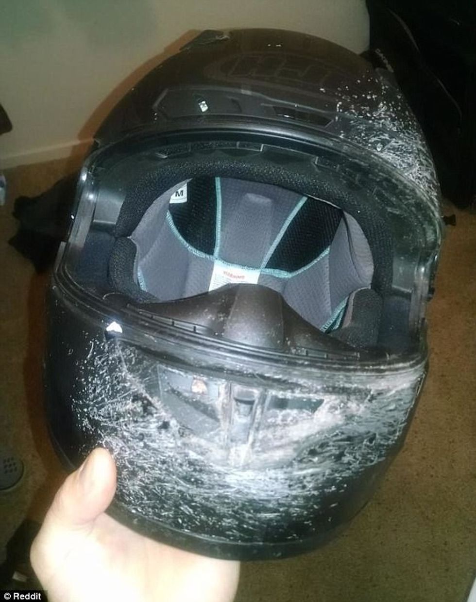Helmetat shpëtojnë jetë dhe këto raste e tregojnë më së miri foto 8