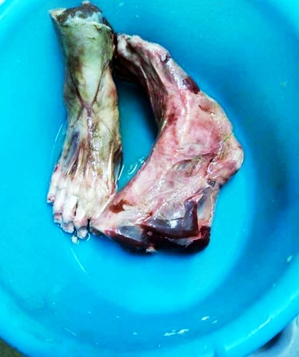 Hetime në restorantin që dyshohet se shërbeu këmbë njeriu foto 2