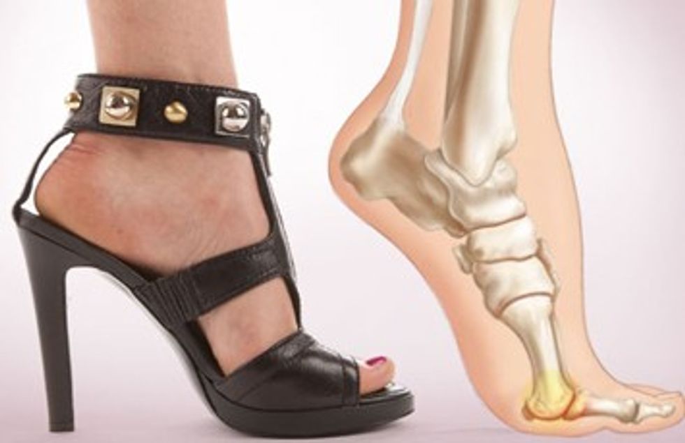 high heels and bones.JPG