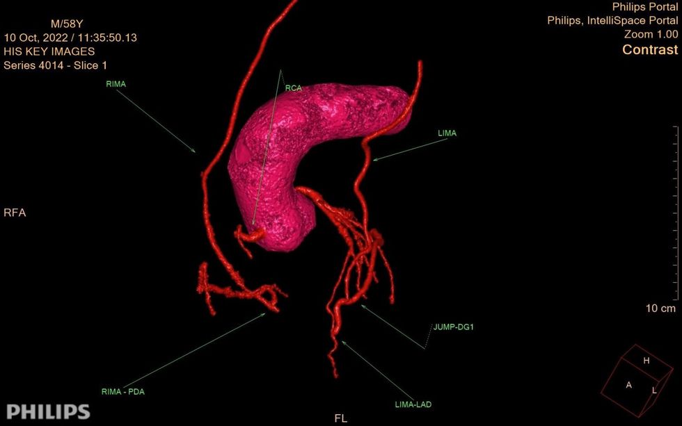 HIS Monday 24 2022 17 58 42 5929 1