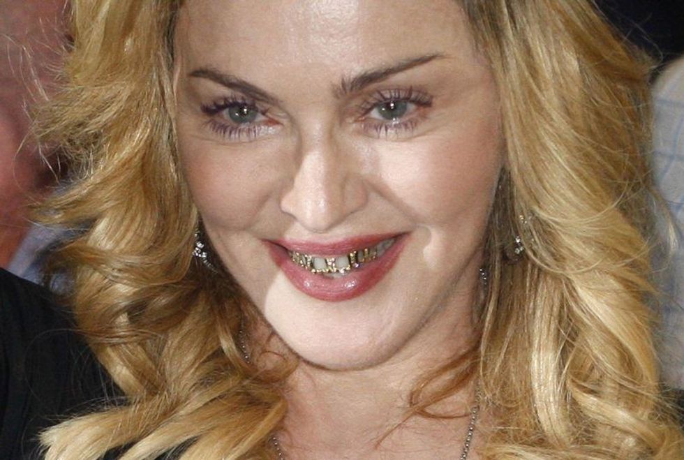 Hollywood Celebrities With Really Bad Teeth 3 1