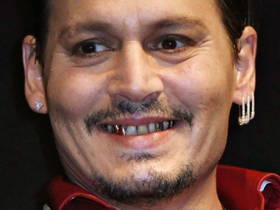 Hollywood Celebrities With Really Bad Teeth 4 1