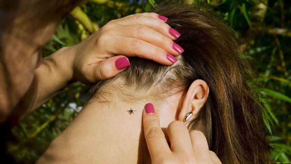 how to remove a tick head that broke off