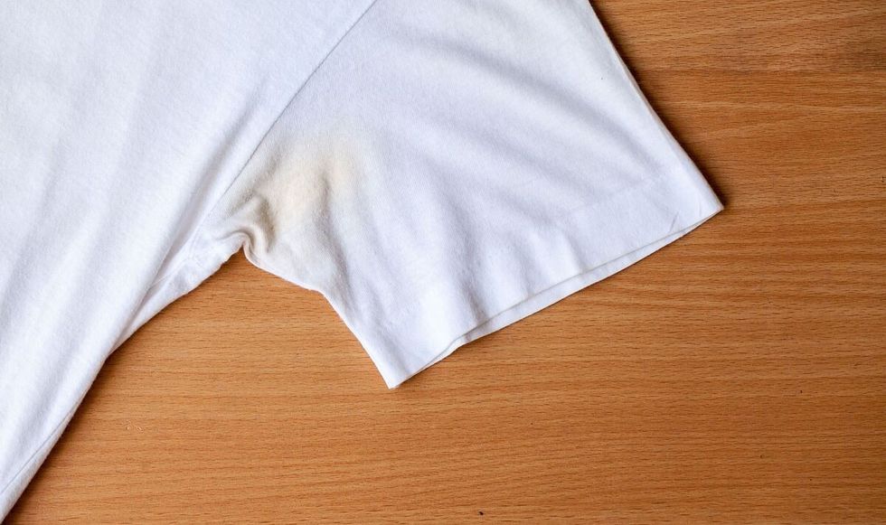 how to remove yellowing from white clothes 5424801 1