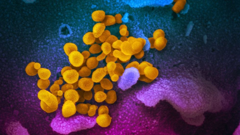 https cdn.cnn .com cnnnext dam assets 200213175742 05 coronavirus 0213