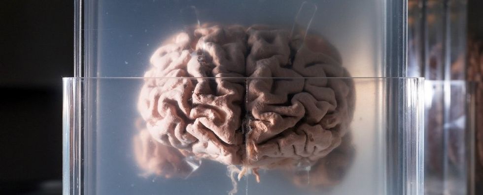 human brain slides shutterstock brain in vat 1024