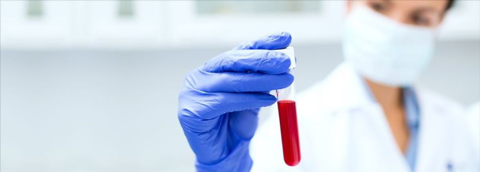 hyperparathyroidism blood test