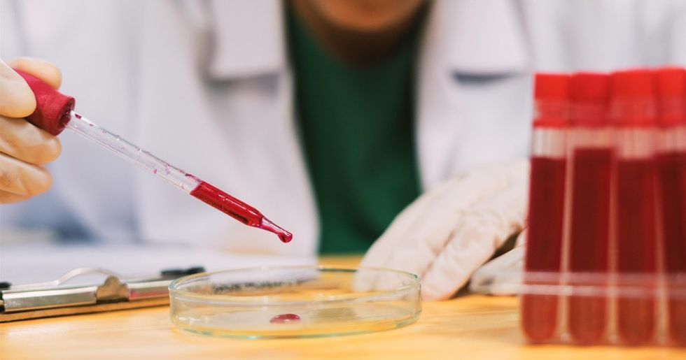 i102660 analyse cholesterol sang