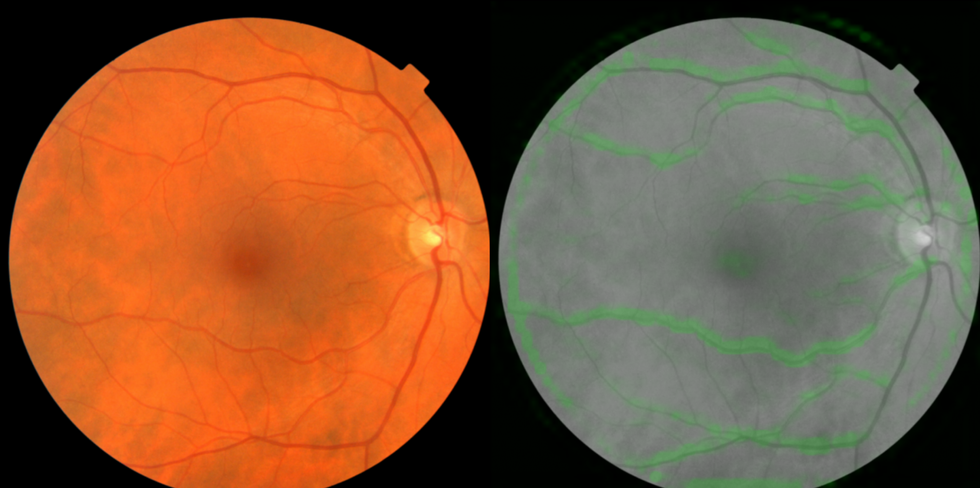 IIQ3WUEDPQ3GZNBKMURETN7CTM scaled