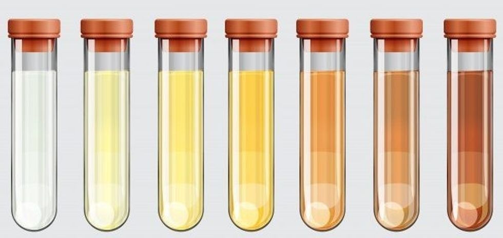 illustration urine color chart 1308 47248 e1613720716988