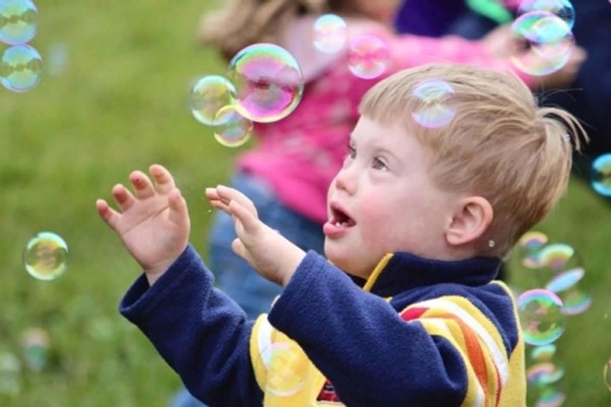 Personat me sindromën Down në Maqedoni, po përballen me sfida të shumta që nga lindja e tyre Personat me sindromën Down në Maqedoni, po përballen me sfida të shumta që nga lindja e tyre