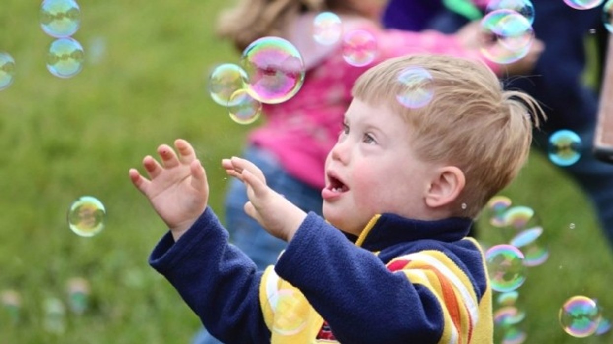 Personat me sindromën Down në Maqedoni, po përballen me sfida të shumta që nga lindja e tyre