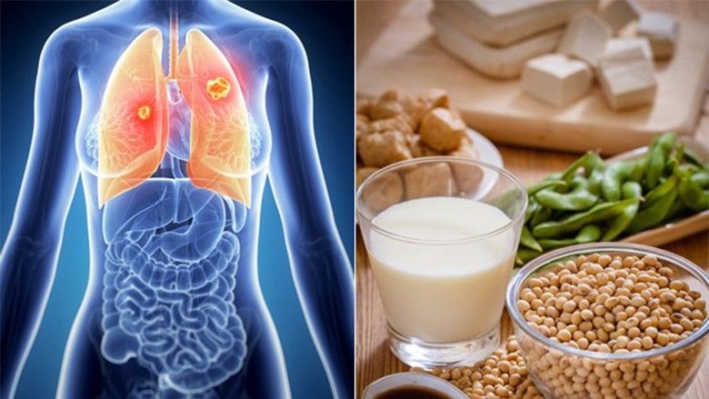 2016/08/diet-lung-soy.jpg