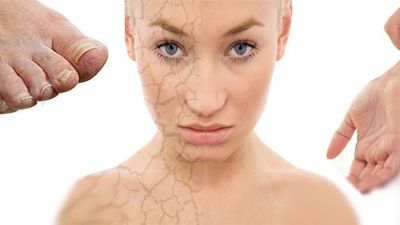 2010/04/dry-skin-diabetes.jpg