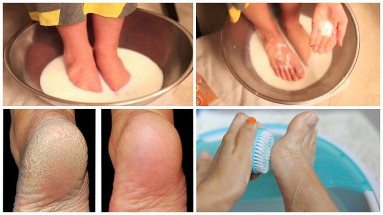 2019/07/dont-spend-money-pedicure-use-two-ingredients-from-your-kitchen-make-feet-look-nice1-768x432.jpg