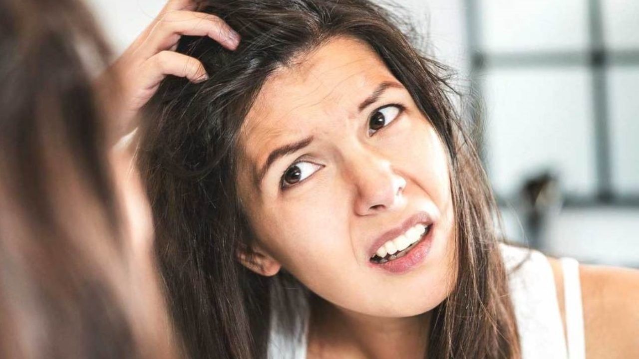 2019/08/Dandruff-home-remedies-for-greasy-hair-1280x720.jpg