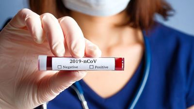 2020/04/0_Nurse-holding-test-tube-with-blood-for-2019-nCoV-analyzing-Novel-Chinese-Coronavirus-blood-test-con.jpg