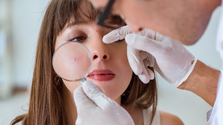 2021/02/woman-pimple-doctor-dermatologist-magnifying-glass.jpg