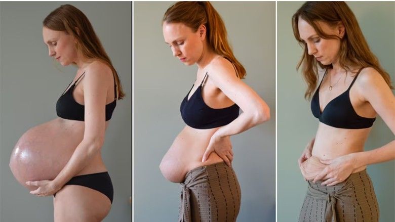 2022/05/what_3_kids_growing_in_one_belly_does_to_your_body.jpg